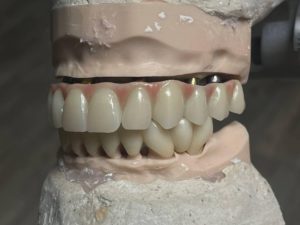 artificial_teeth1